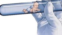 Tüp Bebekte Birden Fazla Embriyo Yerleştirilmesi