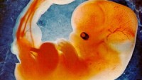 Fetal İzleme Donanımı