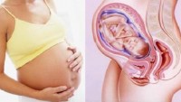 Hamileliğin İlk 3 Ayında Karşılaşılabileceğiniz Sorunlar