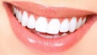 Dişlerimizi Koruyan Önemli Besinler